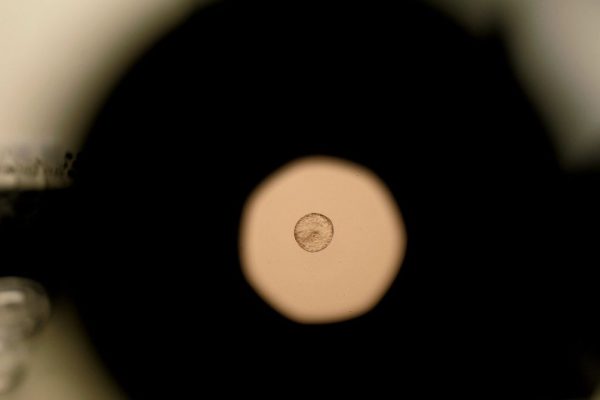 Scientists Just Caught Human Embryo Implantation on Camera